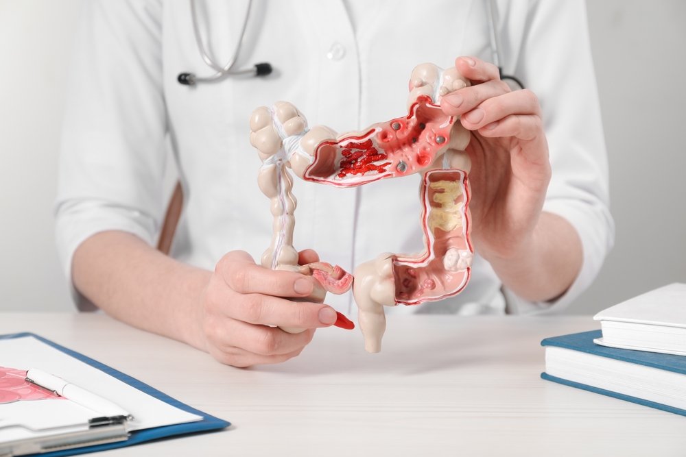 Doctor,With,Model,Of,Large,Intestine,At,Wooden,Table,,Closeup