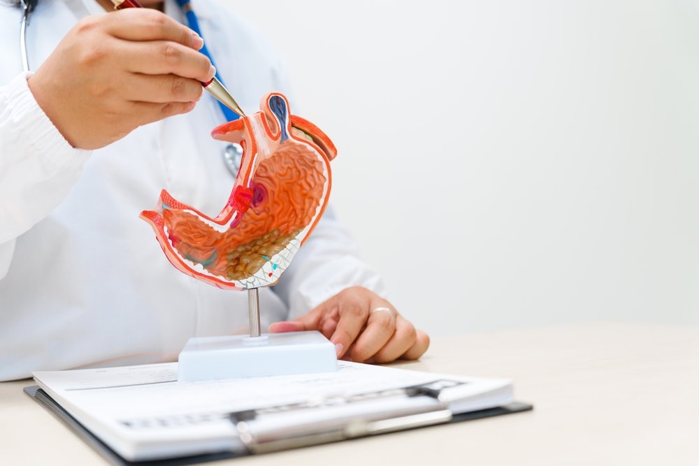 A,Gastroenterologist,Uses,An,Anatomical,Model,To,Explain,Stomach,Problems,
